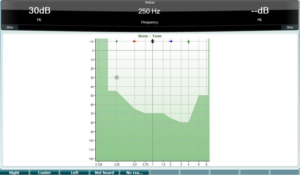 diagnostic-suite-weber-test-interacoustics